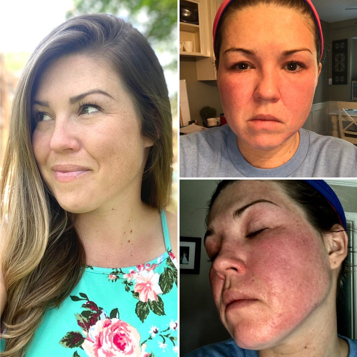 A Stylist’s Truth: What Harsh Chemicals Are Really Doing to Your Hair (and Your Health)