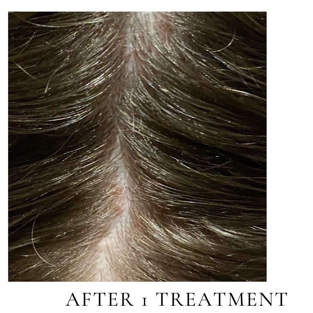 Scalp Repair Oil (Overnight treatment for itchy/dry scalp)